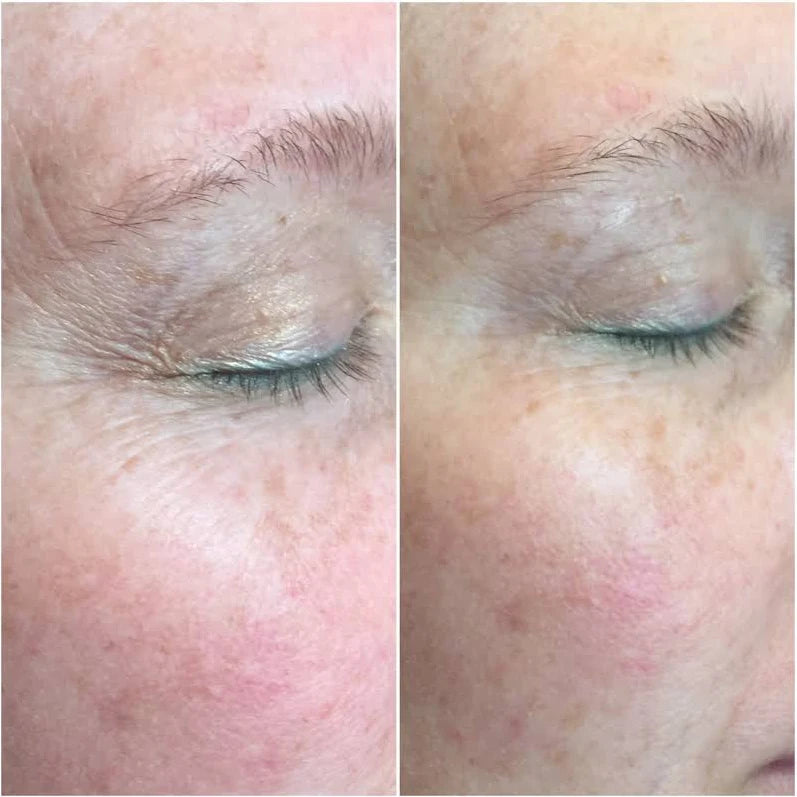 CO2Lift® Pro Mask